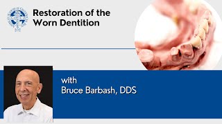 Restoration of the Worn Dentition presented by Bruce Barbash DDS [upl. by Eitsym]