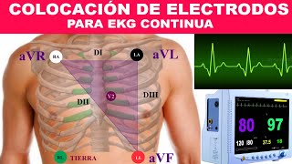 ¿COMO COLOCAR LOS ELECTRODOS PARA MONITORIZACIÓN EKG CONTINUA MONITOR MULTIPARÁMETROS [upl. by Affay812]