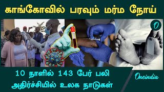 Unknown disease kills 143 in southwest Congo  Oneindia Tamil [upl. by Yroggerg]