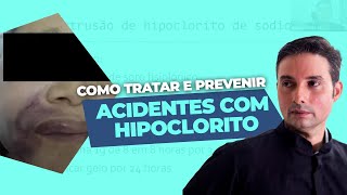 Acidentes com hipoclorito Como tratar e prevenir [upl. by Lenahtan]