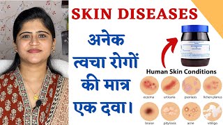 One Medicine for all Skin Diseases ॥अनेक त्वचा रोगों की मात्र एक दवा ॥ [upl. by Marti]