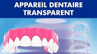 INVISALIGN  Traitement dappareil dentaire TRANSPARENT © [upl. by Eixel]