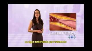 Carboxiterapia  Master Health [upl. by Santini]