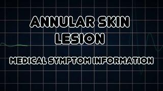 Annular skin lesion Medical Symptom [upl. by Tala542]