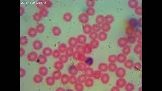 AmScope T690CPL Blood Sample Test [upl. by Aaron676]