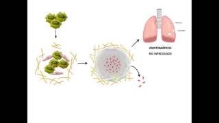 201609  Utilidad de la determinación de ADA en el diagnóstico de tuberculosis extrapulmonar [upl. by Concepcion222]