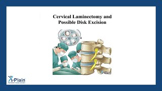 Cervical Laminectomy and Possible Disk Excision [upl. by Lisabeth680]