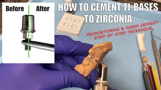 How to Cement TiBases to Zirconia Crowns  Using MicroEtchers and Resin Cement [upl. by Aikram505]