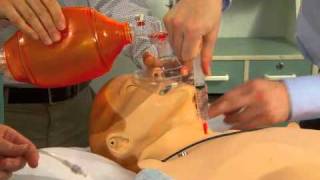 Transtracheal Cannula Oxygenation [upl. by Oberg]