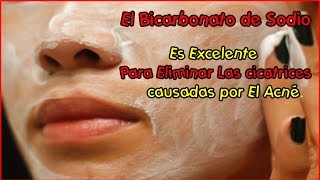 Un excelente remedio casero para eliminar las cicatrices del acne [upl. by Weywadt]