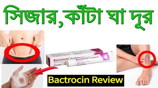 Bactrocin Ointment Cream Review  Easy Way To Get Rid of Thorns [upl. by Riesman]