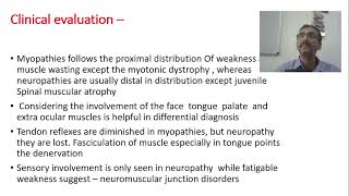 Clinical diagnosis of Muscular dystrophy  part 8 [upl. by Igiul590]