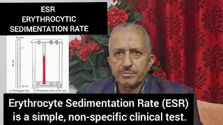 ESR Erythrocytic Sedimentation Rate [upl. by Naujid]