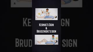 Kernigs Sign and brudzinskis sign shorts medico viral shorts short trending medico physio [upl. by Aninay]