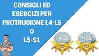 Consigli ed esercizi per protrusione L4L5 o L5S1 [upl. by Waddell]