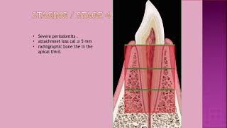 Periodontal Classification Part 1 [upl. by Perri942]