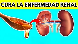 NINGÚN paciente renal volverá a perder un riñón Mira Esto [upl. by Gerbold998]