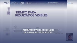 Resultados visibles en el uso de fibroblastos en rostro 🧬 [upl. by Elaen]