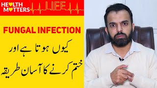 Fungal Infection Treatment  Fungal Infection of Skin In UrduHindi  Fungus Ka Ilaj [upl. by Sandro774]