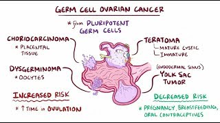 Germ cell ovarian tumors [upl. by Anerev]