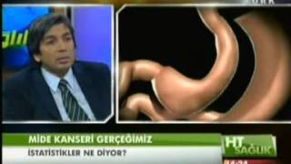 İç Hastalıkları ve Tıbbı Onkoloji Uzmanı Dr M Salih İyikesici Mide Kanserini Anlatıyor 2 [upl. by Glenine]