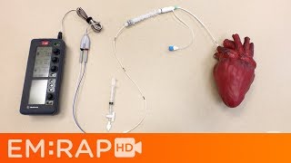 Placing a Transvenous Pacemaker [upl. by Scarface]