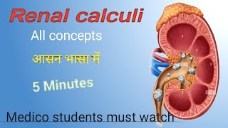 Renal calculi ll Renal stone ll Excretory system disorder ll Nephrolithiasis ll urolithiasis ll [upl. by Eimmas]