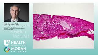 Pathology Lecture Conjunctiva [upl. by Aihsotal]