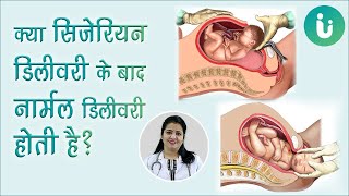 cesarean के बाद normal delivery डिलीवरी हो सकती है क्या  normal delivery after c section tips hindi [upl. by Towland]