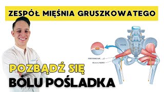 Zespól Mięśnia Gruszkowatego  4 Ćwiczenia Likwidujące Ból [upl. by Ayikan]