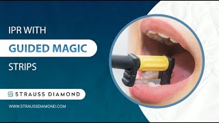 How to Perform IPR with Our New Guided Magic Strip System  Strauss Diamond [upl. by Marice209]