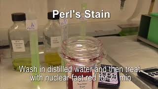 Perls stain for hemosiderin [upl. by Arytal]