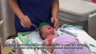 Paediatric Anaesthetics Chapter 3  Failed intubation neonate [upl. by Irtak]