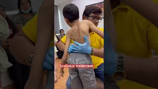 Chiropractic treatment for scoliosis drrajneeshkant [upl. by Meuser]