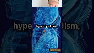 ThyroidHealth Metabolism Hypothyroidism Hyperthyroidism HealthEducation EndocrineSystem [upl. by Liberati]