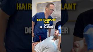 🌟2000 FUE Grafts for a Full Hairline  hairsurgery hairtransplantdoctor fuehairtransplant [upl. by Thier]