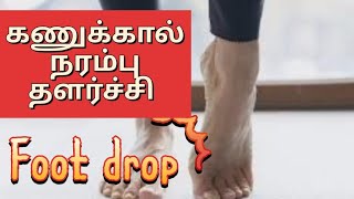 Foot drop exercise peroneal nerve injury [upl. by Wandy518]