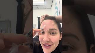 Botox Injecting with Mercedes Part 2 Understanding facial anatomy and Injection Points [upl. by Colwin]