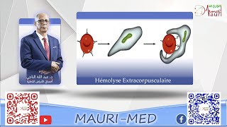 Hématologie  Anémies hémolytiques extracorpusculaires [upl. by Rfinnej451]