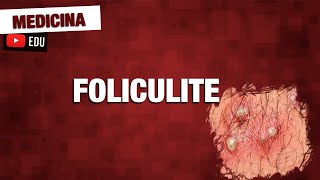 Foliculite bactéria causadora patologia e tratamento [upl. by Clarence137]