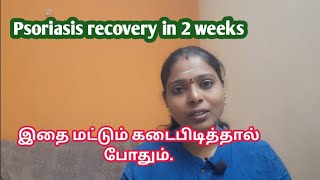 சொரியாசிஸ் முற்றிலும் குணமாக  Psoriasis recovery  சொரியாசிஸ் மருத்துவ முறை  Psoriasis cure story [upl. by Jocelin]