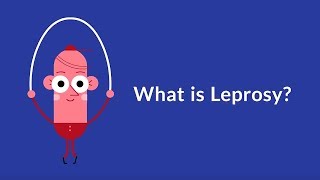 What is Leprosy Chronic Infectious Disease [upl. by Shoemaker301]