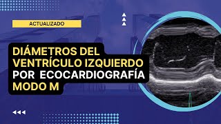 ✅DIAMETROS DEL VENTRICULO IZQUIERDO por Ecocardiografía MODO M 💡Actualizado [upl. by Nancie547]