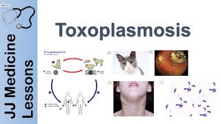 Toxoplasmosis  Acquired vs Congenital  Signs Symptoms Diagnosis and Treatment [upl. by Abad]