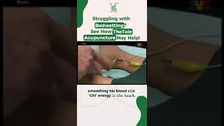 BEDWETTING MANAGEMENT  TheTole Acupuncture amp TheTole Herbs [upl. by Marilee]