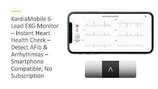 KardiaMobile 6Lead EKG Monitor – Instant Heart Health Check – Detect AFib amp Arrhythmias [upl. by Anigger485]