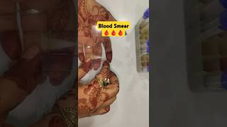 Blood Smear lab ytshorts medical shortsfeed safecarepoint [upl. by Sivra]