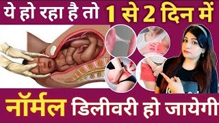 Symptoms Of Labour Pain In Hindi l प्रसव शुरू होने के लक्षण l Signs Of Labour Pain In Hindi [upl. by Tripp]