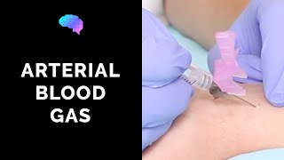 How to take an arterial blood gas ABG  OSCE guide  UKMLA  CPSA [upl. by Ahsenor]