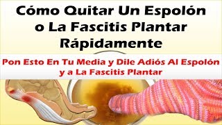 Pon Esto En Tu Media y Dile Adiós Al Espolon y a La Fascitis Plantar Como Quitar Un Espolon Rapido [upl. by Cirdec]